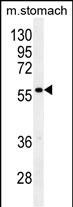 WB - Glypican 3 (GPC3) Antibody (N-term) AP6337a